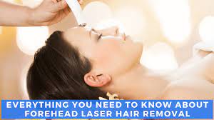 forehead hairs forever laser removal