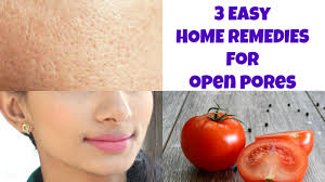 large pores with diy face masks
