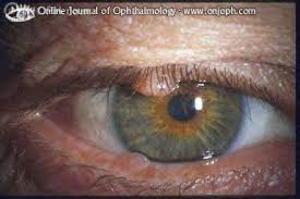 atlas of ophthalmology