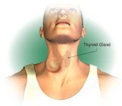 Follicular thyroid cancer makes up about 10% to 15% of all thyroid cancers in the united states. Thyroid Cancer Types Symptoms Diagnosis Treatment Pmcc Denver Oncology Denver Concierge Medicine