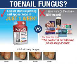 kerasal forcell usa