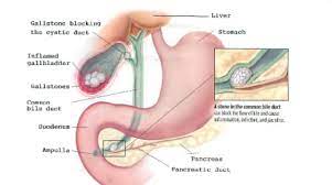 laparoscopic gallbladder surgery