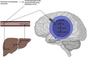 acute neurological diseases