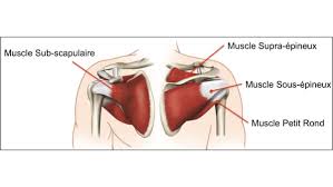Athletes at risk for a patellar tendon rupture. La Rupture Du Tendon Subscapulaire Clinique De L Epaule Du Coude