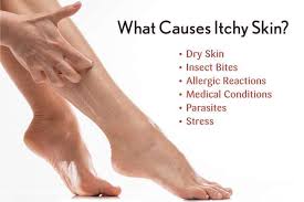 home remes for itchy skin femina in