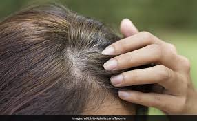 But having dry hair doesn't mean that you have a larger health problem moroccan argan oil has become a popular home remedy for dry hair. Got Grey Hair These 5 Home Remedies Can Work Better Than Hair Dyes And Hair Colours