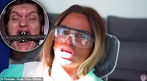 'it wouldn't be a holiday, would it, unless pricey gets something done? Katie Price Shows Off Her Metal Teeth As She Gets Veneers Fitted Daily Mail Online