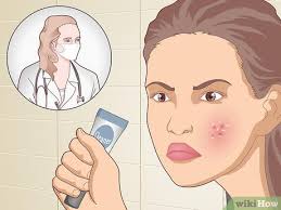 4 ways to prevent acne naturally wikihow