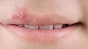 what can cause a lip rash with pictures