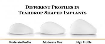 5 Things You Should Know About Size Shape Profile Of