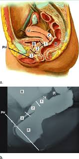 anatomic levels of pelvic fl oor