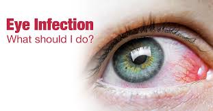 an overview of eye infections symptoms
