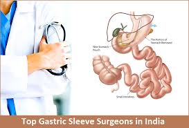 top 10 gastric sleeve surgeons in india
