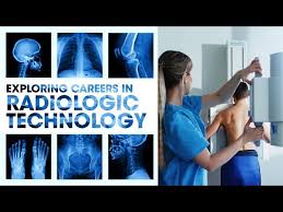 radiologic x ray technology start a