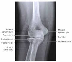Most common elbow fracture in patients age <8yr. Elbow Ap Projection Radtechonduty