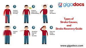 stroke recovery guide