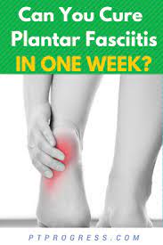 can you cure plantar fasciitis in one week