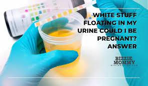 white stuff floating in my urine could