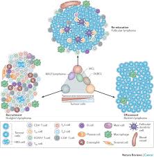 The two main kinds of lymphoma are— hodgkin lymphoma, which spreads in an orderly manner from one group of lymph nodes to another. The Tumour Microenvironment In B Cell Lymphomas Nature Reviews Cancer