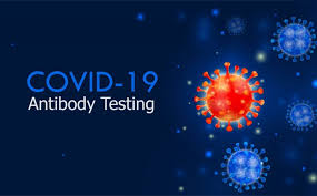 covid 19 igm and igg antibody testing