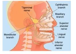 can trigeminal neuralgia be cured