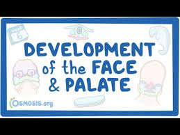 cleft lip and palate causes diagnosis