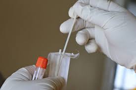 A lateral flow test kit works by taking a sample from the nose or back of the throat via a swab. What Is Lateral Flow Testing And How Could It Be Deployed Against Coronavirus Gavi The Vaccine Alliance