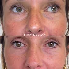 freckles with permanent makeup sian