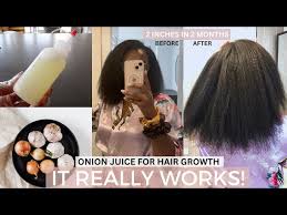 onion juice for hair growth how to