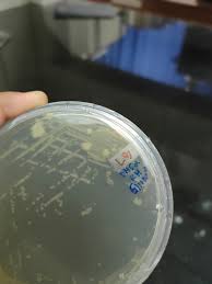 contamination in my lb agar plate