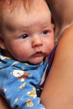 is it a viral rash baby toddler rash
