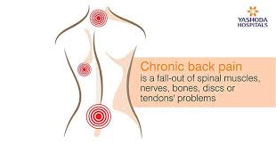 back pain specialist in hyderabad