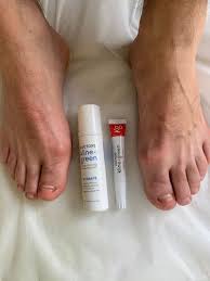 will toenail fungus go away without