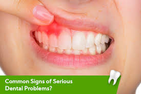 common signs of serious dental problems