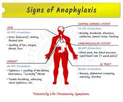 Anaphylaxis 101 Signs Treatment More Epinephrine
