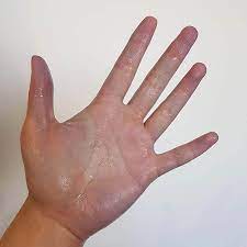 getting hair dye off your hands lab