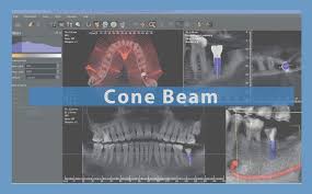 cbct cone beam computed tomography