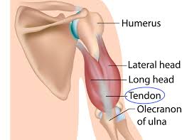 triceps tendonitis the weightlifter s