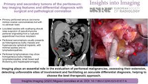 primary and secondary tumors of the
