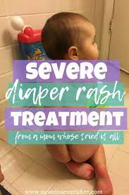 severe diaper rash treatment from a