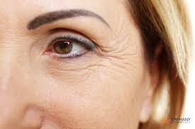 are there diffe types of wrinkles