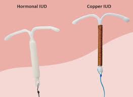 intrauterine device iud types