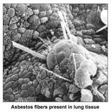 study essing asbestos fiber burden