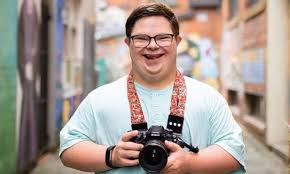 It affects 1 in 800 to 1 in 1000 live born infants. 23 Yr Old Us Man With Down Syndrome Becomes Award Winning Travel Photographer