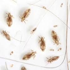 home remes for lice say goodbye for