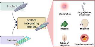 Implants With Sensing Capabilities