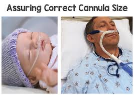Oxygen flow rate and fio2 table High Flow Nasal Cannula Hfnc Part 1 How It Works Rebel Em Emergency Medicine Blog