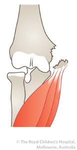 Want to learn more about it? Clinical Practice Guidelines Medial Epicondyle Fracture Of The Humerus Emergency Department