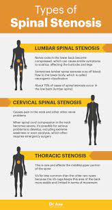 spinal stenosis symptoms causes