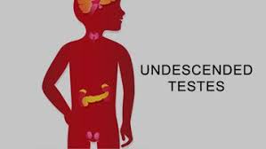 The tail, abdominal fat, and portions of the kidneys and testes may or may not be present. Undescended Testis Diseases And Conditions Pediatric Oncall